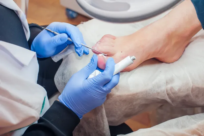 Medische pedicurebehandeling met handschoenen en steriele instrumenten